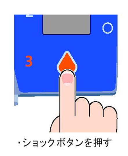 ショックボタンを押す ショックボタンを押す
